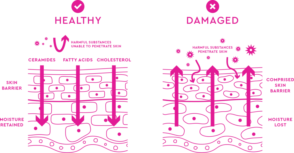 Une comparaison entre une barrière cutanée saine et une barrière cutanée endommagée, mettant en avant la rétention d'hydratation et la protection par rapport à la perte d'hydratation et à la vulnérabilité.